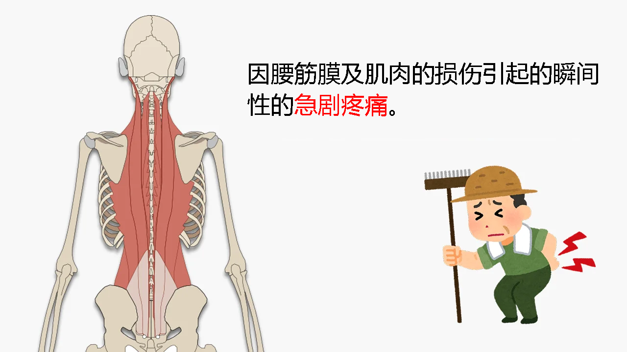 下背部的筋膜和肌肉受伤会导致突然的疼痛。